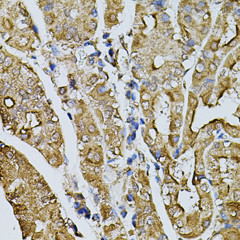Immunohistochemistry - MYL1 Polyclonal Antibody 