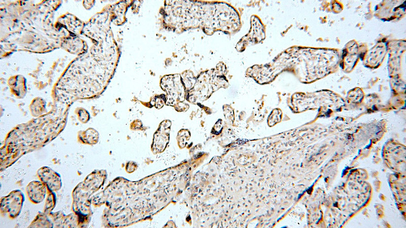 Immunohistochemical of paraffin-embedded human placenta using Catalog No:116285(TNFAIP1 antibody) at dilution of 1:50 (under 10x lens)