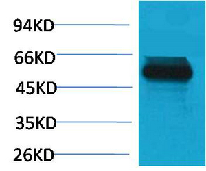 Fig1:; Western blot analysis of Mouse skeletal muscle using TRIM72 Polyclonal Antibody.. Secondary antibody（catalog#: HA1001) was diluted at 1:20000