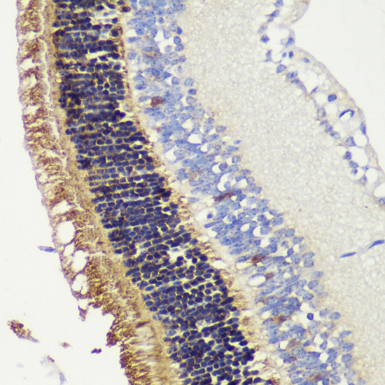 Immunohistochemistry - RCVRN Polyclonal Antibody 