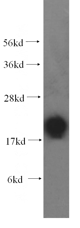 human brain tissue were subjected to SDS PAGE followed by western blot with Catalog No:110757(FXYD6 antibody) at dilution of 1:400