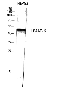 Fig1:; Western Blot analysis of HEPG2 using LPAAT-θ Polyclonal Antibody diluted at 1: 1000