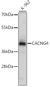 Western blot - CACNG4 Polyclonal Antibody 