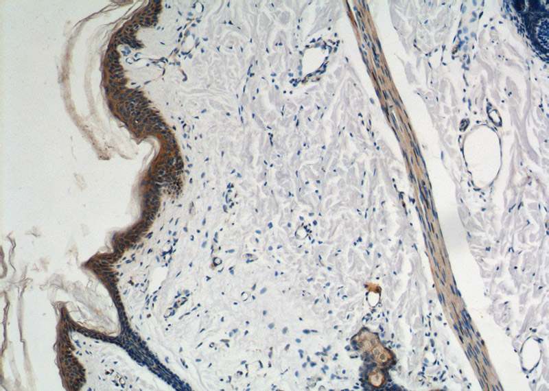 Immunohistochemistry of paraffin-embedded human skin tissue slide using Catalog No:113938(PKP3 Antibody) at dilution of 1:200 (under 10x lens).