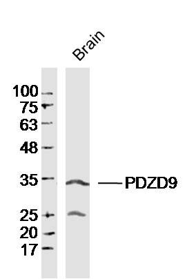 Fig2: Sample: Brain (Mouse) Lysate at 40 ug; Primary: Anti-PDZD9 at 1/300 dilution; Secondary: IRDye800CW Goat Anti-Rabbit IgG at 1/20000 dilution; Predicted band size: 30kD; Observed band size: 30kD