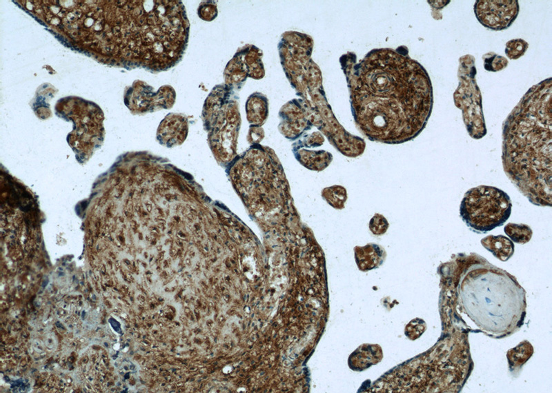Immunohistochemistry of paraffin-embedded human placenta tissue slide using Catalog No:116741(C14orf115 Antibody) at dilution of 1:50 (under 10x lens)