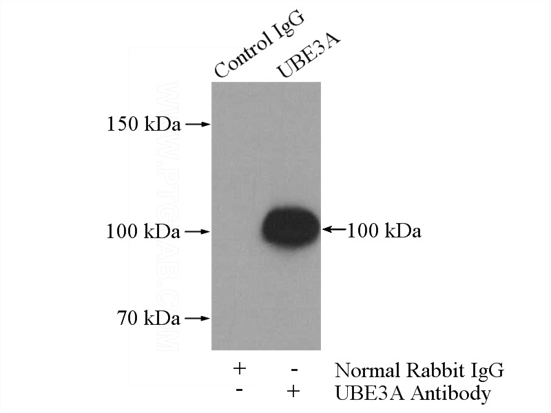 IP Result of anti-UBE3A (IP:Catalog No:116541, 4ug; Detection:Catalog No:116541 1:300) with mouse brain tissue lysate 4000ug.