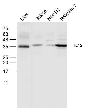 Fig2: Sample:; Liver (Mouse) Lysate at 40 ug; Spleen (Mouse) Lysate at 40 ug; NIH/3T3 (Mouse) CellLysate at 30 ug; RAW246.7 (Mouse) CellLysate at 30 ug; Primary: Anti- IL12 at 1/300 dilution; Secondary: IRDye800CW Goat Anti-Rabbit IgG at 1/20000 dilution; Predicted band size: 22 kD; Observed band size: 35/36 kD