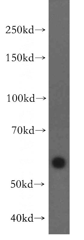 SH-SY5Y cells were subjected to SDS PAGE followed by western blot with Catalog No:116349(TRAPPC9 antibody) at dilution of 1:300