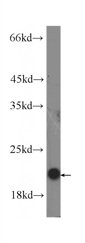 Recombinant protein were subjected to SDS PAGE followed by western blot with Catalog No:107378(IL10 Antibody) at dilution of 1:5000