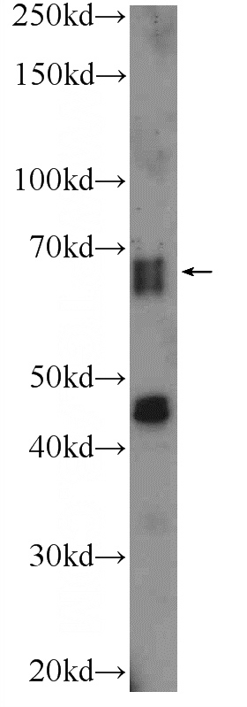 mouse brain tissue were subjected to SDS PAGE followed by western blot with Catalog No:115293(SLAIN2 Antibody) at dilution of 1:300