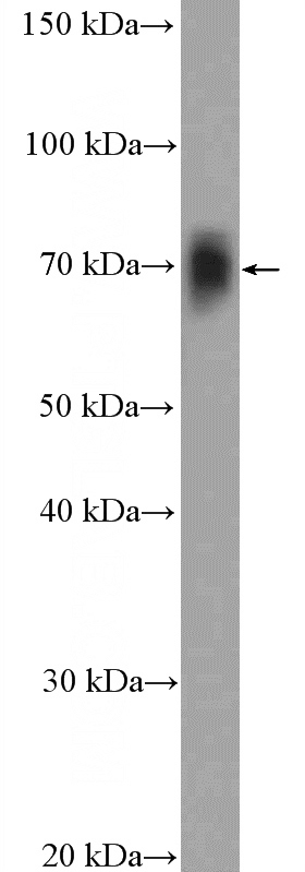 rat brain tissue were subjected to SDS PAGE followed by western blot with Catalog No:109209(CHAT Antibody) at dilution of 1:600