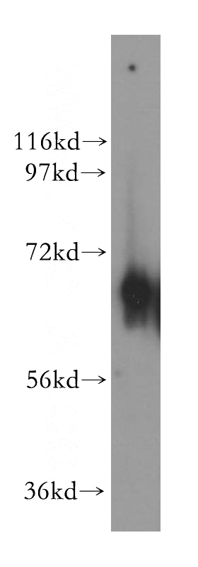 human placenta tissue were subjected to SDS PAGE followed by western blot with Catalog No:113392(NT5C2 antibody) at dilution of 1:300