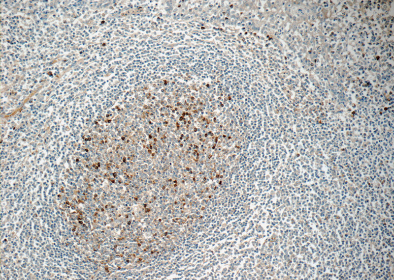 Immunohistochemistry of paraffin-embedded human tonsillitis tissue slide using Catalog No:111632(IGJ Antibody) at dilution of 1:50 (under 10x lens)