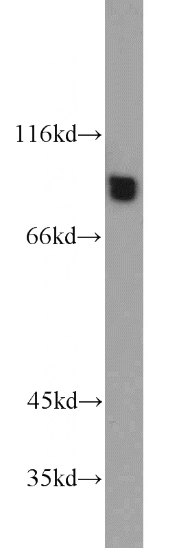 K-562 cells were subjected to SDS PAGE followed by western blot with Catalog No:111321(GYS1 antibody) at dilution of 1:500