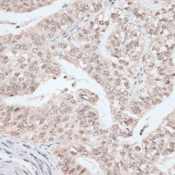 Immunohistochemistry - RBM17 Polyclonal Antibody 