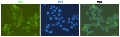Immunocytochemistry staining of HeLa cells fixed with 4% Paraformaldehyde and using anti-S6 Ribosomal Protein mouse mAb (dilution 1:200).