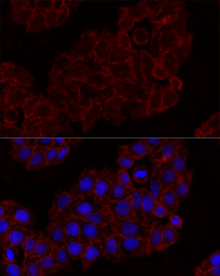 Immunofluorescence - KLRK1 Polyclonal Antibody 