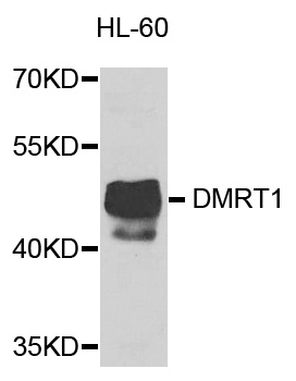 Western blot - DMRT1 Polyclonal Antibody 