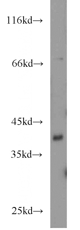 mouse kidney tissue were subjected to SDS PAGE followed by western blot with Catalog No:108383(BCAT2 antibody) at dilution of 1:800