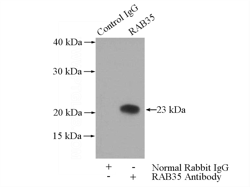 IP Result of anti-RAB35 (IP:Catalog No:114434, 4ug; Detection:Catalog No:114434 1:600) with mouse brain tissue lysate 3440ug.