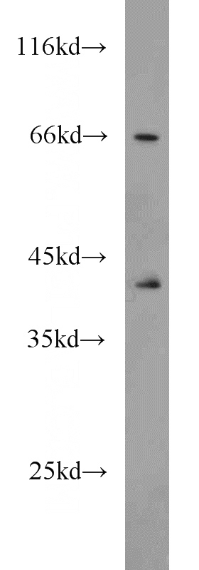 mouse thymus tissue were subjected to SDS PAGE followed by western blot with Catalog No:115123(SEPT9 antibody) at dilution of 1:600