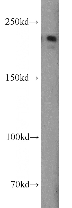 human brain tissue were subjected to SDS PAGE followed by western blot with Catalog No:108760(CACNA1S antibody) at dilution of 1:1000