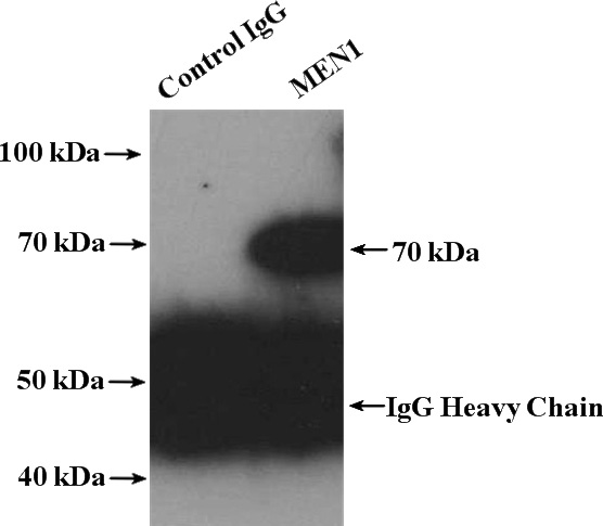 IP Result of anti-MEN1 (IP:Catalog No:112653, 4ug; Detection:Catalog No:112653 1:500) with HepG2 cells lysate 3200ug.