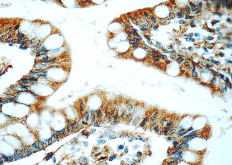 Immunohistochemistry of paraffin-embedded human small intestine tissue slide using Catalog No:108210(ASB13 Antibody) at dilution of 1:50 (under 40x lens)
