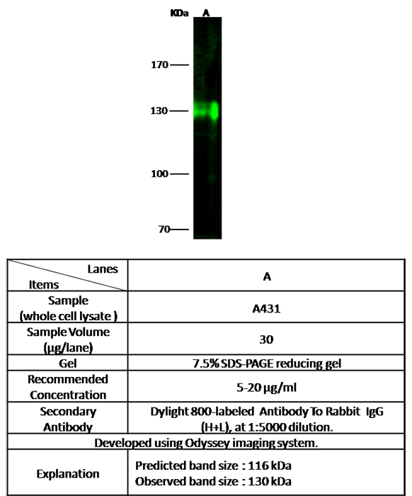 Integrin alpha V / CD51 / ITGAV Antibody, Rabbit PAb, Antigen Affinity Purified, Western blot