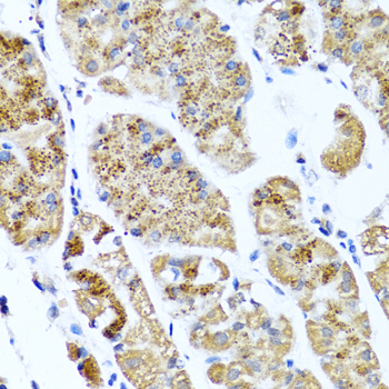 Immunohistochemistry - COL10A1 Polyclonal Antibody 
