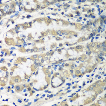 Immunohistochemistry - CCT6A Polyclonal Antibody 