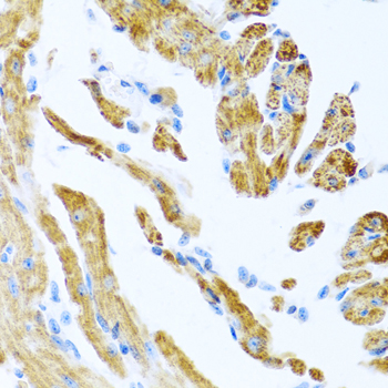 Immunohistochemistry - COL9A3 Polyclonal Antibody 