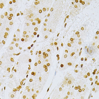 Immunohistochemistry - DKC1 Polyclonal Antibody 