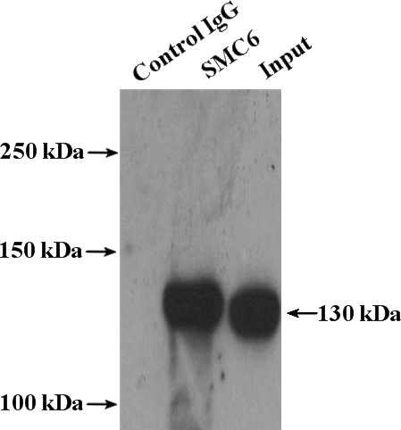 IP Result of anti-SMC6 (IP:Catalog No:115383, 4ug; Detection:Catalog No:115383 1:1000) with mouse testis tissue lysate 4000ug.