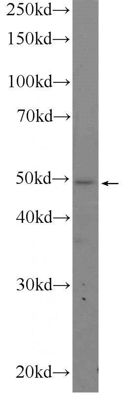 RAW 264.7 cells were subjected to SDS PAGE followed by western blot with Catalog No:107969(ALDH3B1 Antibody) at dilution of 1:300