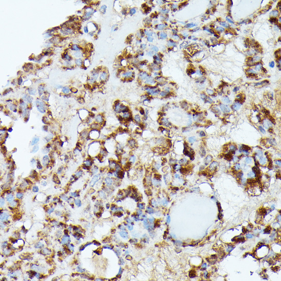 Immunohistochemistry - NUBP1 Polyclonal Antibody 