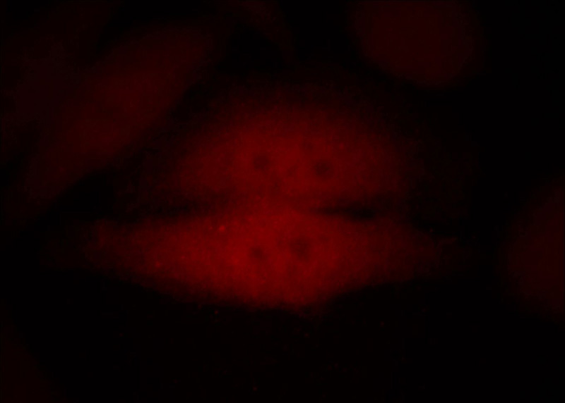 Immunofluorescent analysis of HepG2 cells, using SMAD4 antibody Catalog No: at 1:25 dilution and Rhodamine-labeled goat anti-rabbit IgG (red).