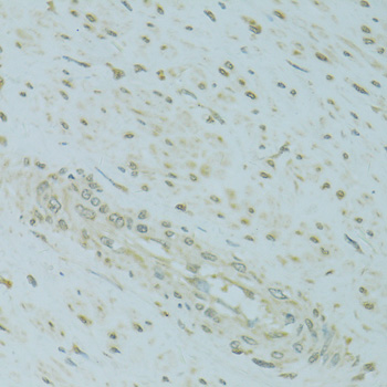 Immunohistochemistry - MBD2 Polyclonal Antibody 