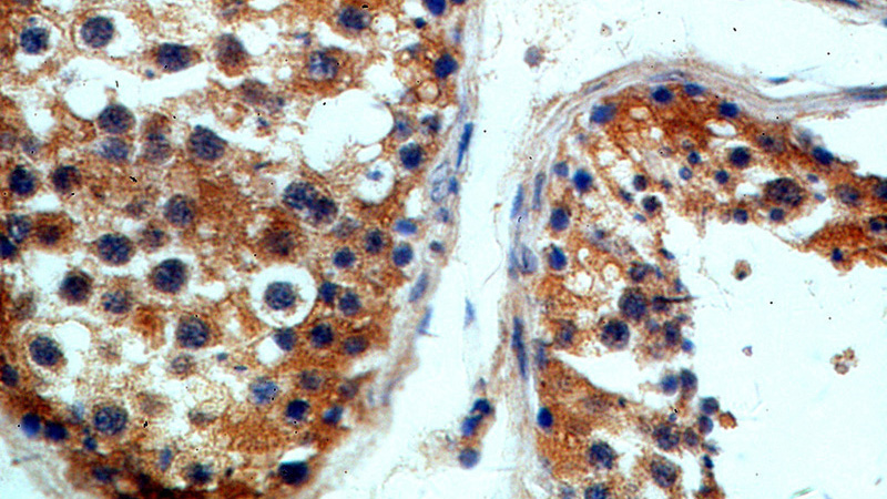 Immunohistochemical of paraffin-embedded human testis using Catalog No:111960(ITPR1-specific antibody) at dilution of 1:100 (under 40x lens)