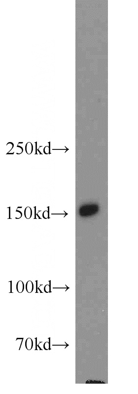 human testis tissue were subjected to SDS PAGE followed by western blot with Catalog No:113213(NPHP3 antibody) at dilution of 1:500
