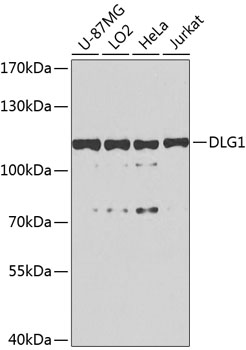 Western blot - DLG1 Polyclonal Antibody 