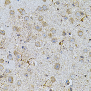 Immunohistochemistry - NAT8 Polyclonal Antibody 