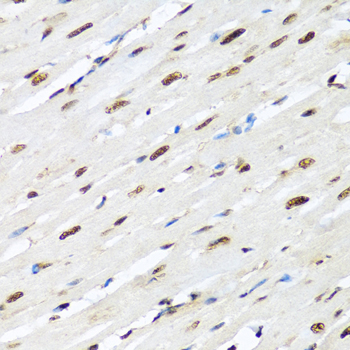 Immunohistochemistry - HNRNPR Polyclonal Antibody 