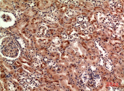 Fig2:; Immunohistochemical analysis of paraffin-embedded human-kidney, antibody was diluted at 1:100