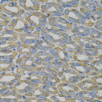 Immunohistochemistry - TRIM27 Polyclonal Antibody 