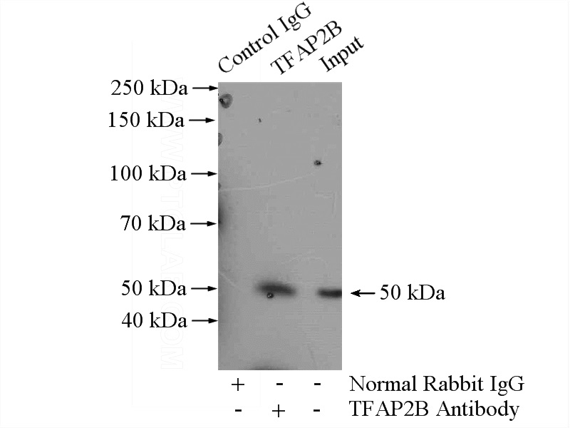 IP Result of anti-TFAP2B (IP:Catalog No:115999, 4ug; Detection:Catalog No:115999 1:500) with MCF-7 cells lysate 800ug.