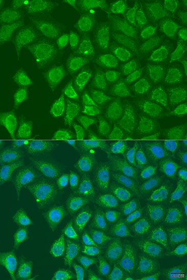 Immunofluorescence - HOXD10 Polyclonal Antibody 