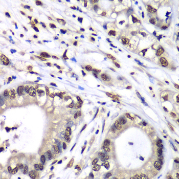 Immunohistochemistry - HNRNPM Polyclonal Antibody 