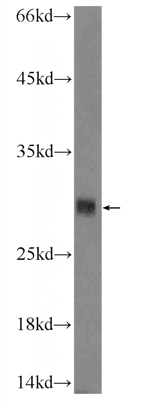K-562 cells were subjected to SDS PAGE followed by western blot with Catalog No:109023(CD300LF Antibody) at dilution of 1:1500